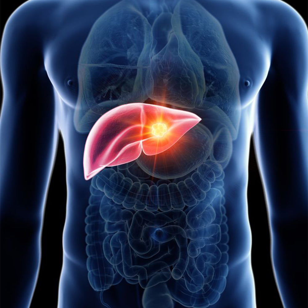 Fatty Liver Diet Plan